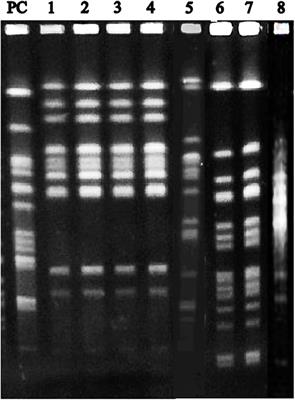 Comparative Analysis Using Pulsed-Field Gel Electrophoresis Highlights a Potential Transmission of Salmonella Between Asymptomatic Buffaloes and Pigs in a Single Farm